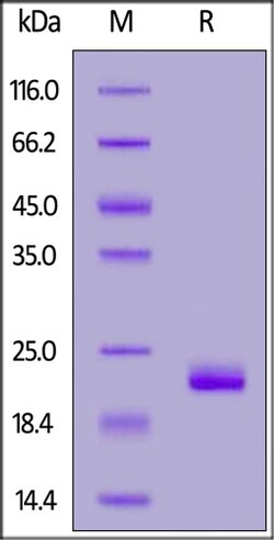 ACROBiosystems Human ZNRF3 protein, His Tag, Quantity: Each of 1