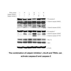 Apexbio Technology LLC&nbsp;Calpain Inhibitor I, ALLN(Synonyms: ALLN, N-Acetyl-Leu-Leu-Nle-CHO, Ac-LLnL-CHO, Calpeptin, MG101, CI-I), 5mg, CAS: 110044-82-1.
