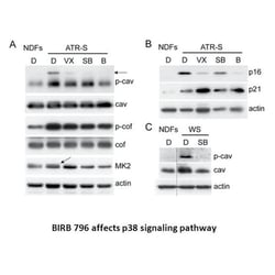 Apexbio Technology LLC BIRB 796 (Doramapimod), 10mg. Cas: 285983-48-4 MFCD: