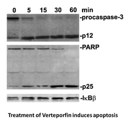 Apexbio Technology LLC Verteporfin, 129497-78-5, MFCD11982858, 5 mg, Quantity: