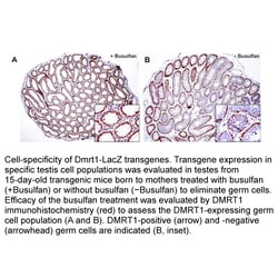Apexbio Technology LLC Busulfan, 1g. Cas: 55-98-1 MFCD: MFCD00007562. DNA