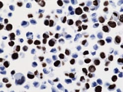 REVMAB BIOSCIENCES USA INC Histone H3 K36M [RM193], Rabbit Monoclonal Antibody,