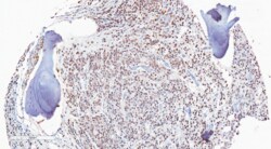 REVMAB BIOSCIENCES USA INC AR (ARv7 Splice Variant) [RM7], Rabbit Monoclonal