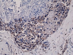 REVMAB BIOSCIENCES USA INC&nbsp;Phospho-Akt (Ser473) [RM251], Rabbit Monoclonal Antibody