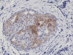 REVMAB BIOSCIENCES USA INC Phospho-EGFR (Y1173) [RM269], Rabbit Monoclonal