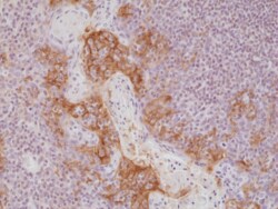 REVMAB BIOSCIENCES USA INC PD-L1 (CD274) (B7-H1) [RM320], Rabbit Monoclonal