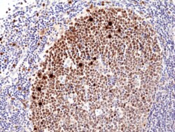 REVMAB BIOSCIENCES USA INC KI67 [RM360], Rabbit Monoclonal Antibody, Quantity: