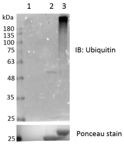 Ubpbio K29/K33 PolyUb Chain Capture Kit, Quantity: Each of 1