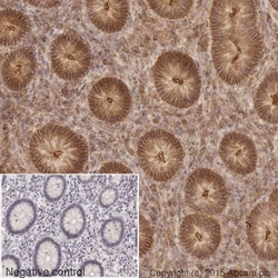 enQuire Bioreagents Anti-beta Actin antibody | 50ug, Quantity: Each of