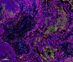 Akoya Biosciences Opal Polaris 7 Color Automation IHC Kit, Quantity: Each