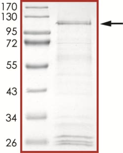 Sino Biological&nbsp;Recombinant Human WEE1 Protein (Full Length, GST Tag), Active