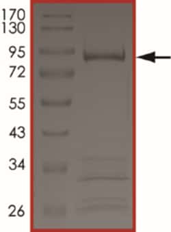 Sino Biological&nbsp;Recombinant Mouse WNK4 Protein (GST Tag), Active