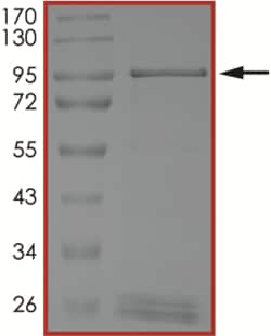 Sino Biological&nbsp;Recombinant Mouse WEE2 Protein (Full Length, GST Tag), Active