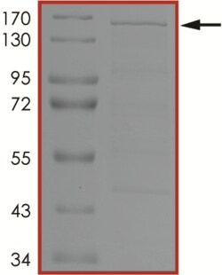 Sino Biological&nbsp;Recombinant Human WWP1 Protein (Full Length, GST Tag)