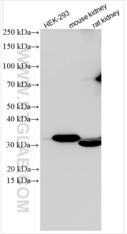 WNT7A Rabbit, anti-Human, Polyclonal, Proteintech:Antibodies:Primary Antibodies