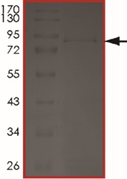 Sino Biological&nbsp;Recombinant Human YES1 Protein (Full Length, T348I, GST Tag), Active