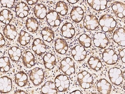 Sino Biological YAP1 Antibody, Rabbit PAb, Antigen Affinity Purified 100uL,