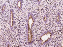 Sino Biological Anti-YIPF4 Antibody, Rabbit Polyclonal, Quantity: Each