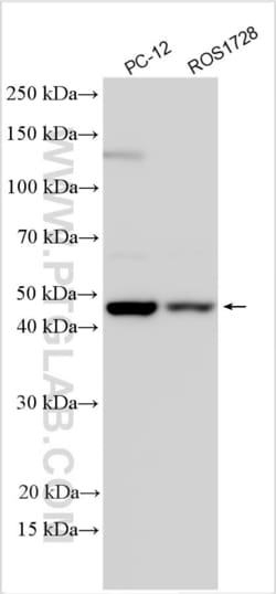 ZIC1 Rabbit, anti-Human, Polyclonal, Proteintech:Antibodies:Primary Antibodies