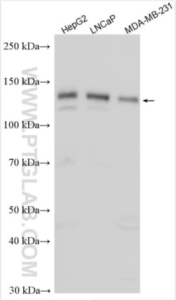ZNF217 Rabbit, anti-Human, Polyclonal, Proteintech Quantity: 150 &mu;L:Antibodies
