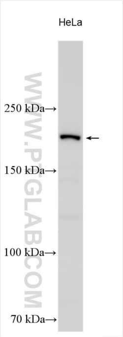 ZNFX1 Rabbit, anti-Human, Polyclonal, Proteintech Quantity: 20 &mu;L:Antibodies