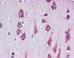 Abcam Anti-Rapsyn antibody, 50 ug