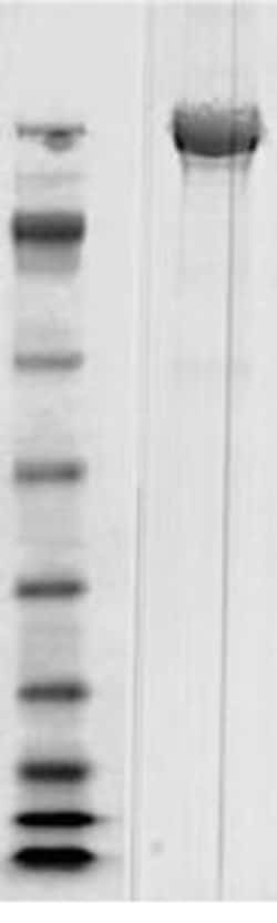 Abcam&nbsp;Native Clostridium difficile Toxin B protein