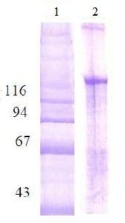 Abcam&nbsp;Native Human Collagen II protein