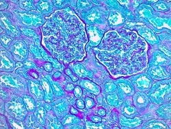 Abcam&nbsp;Periodic Acid Schiff (PAS) Stain Kit (Mucin Stain)