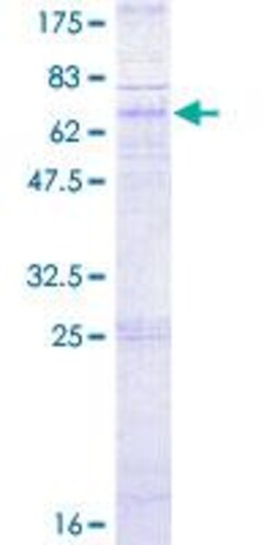 Abcam&nbsp;Recombinant Human CXCR5 protein (GST tag N-Terminus)