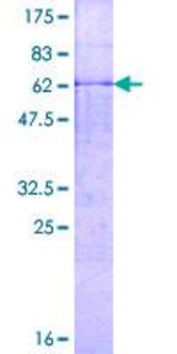 Abcam&nbsp;Recombinant Human MMP23 protein (GST tag N-Terminus)