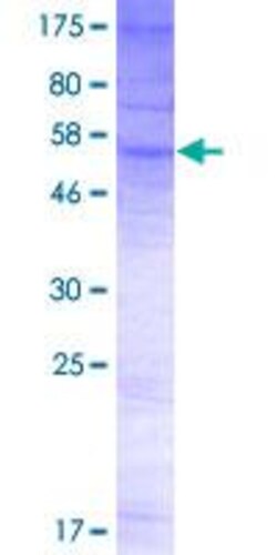Abcam&nbsp;Recombinant Human OSTA protein (GST tag N-Terminus)
