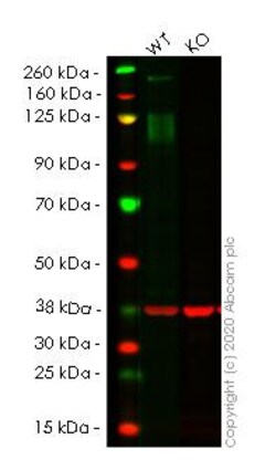 Abcam&nbsp;Human IGF1R (IGF1 Receptor) knockout HeLa cell line