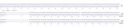 Abcam&nbsp;Human GSN knockout U-87 MG cell line