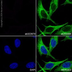 Abcam&nbsp;PE Mouse IgG1 monoclonal [R312-MouseIgG1]-Isotype control