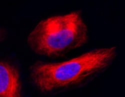 Abcam&nbsp;Live Cell Tubulin Staining Kit (Fluorimetric)