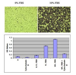 Abcam&nbsp;Cell Migration Assay (8 &mu;m)