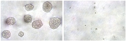 Abcam&nbsp;In Vitro Tumor Sensitivity Assay (Soft Agar Colony Formation)