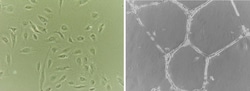Abcam&nbsp;Endothelial Tube Formation Assay (In Vitro Angiogenesis Assay)
