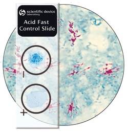 StatLab Acid Fast Control Slides