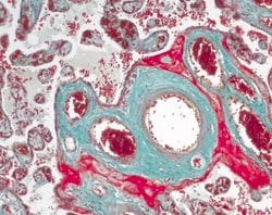 MilliporeSigma Masson-Goldner Staining Kit