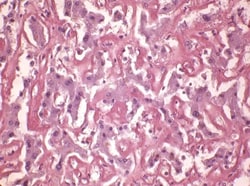 StatLab HCS Control Slides Amyloid 8 Micron Adhesion Slides