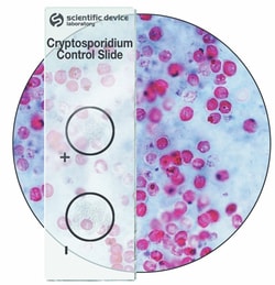 StatLab Cryptosporidium Control Slides