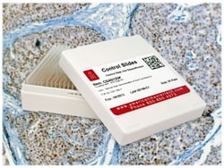 StatLab&nbsp;Breast Carcinoma Control Slides