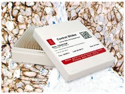 StatLab&nbsp;Breast Carcinoma c-erB-2PLUS Control Slides