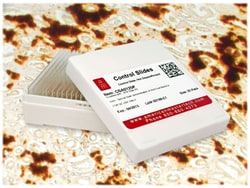 StatLab&nbsp;Calcium Control Slides