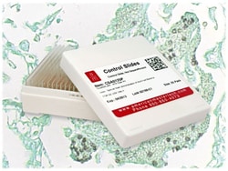 StatLab&nbsp;Pneumocystis Control Slides