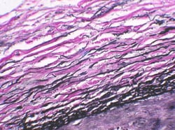 StatLab HCS Control Slides Elastic Tissue Slides