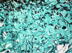 StatLab HCS Control Slides Fungus Adhesion Slides