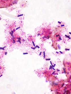 StatLab HCS Control Slides Gram Adhesion Slides
